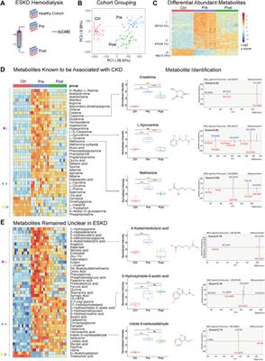 Integrated metabolomics and proteomics reveal biomarkers associated with hemodialysis in end-stage kidney disease